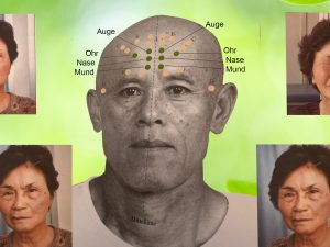 Laser(aku)punktur Seminar